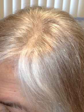 אחרי השלמת שיער