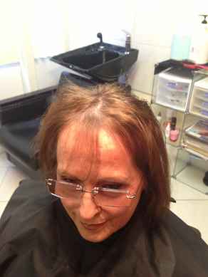 לפני השלמה לשיער דליל