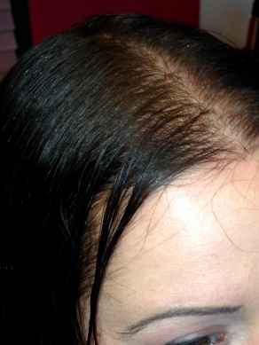 לפני שזירת שיער